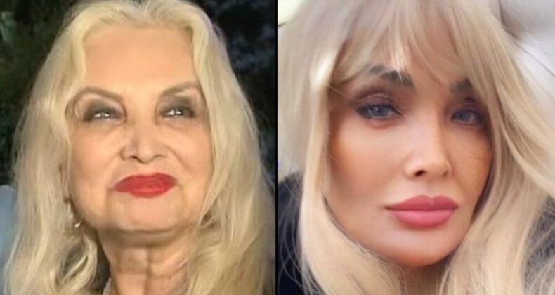 Orhan Gencebay’ın hayat arkadaşı Sevim Emre’den filtre iddialarına cevap verdi: